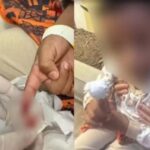 Menino de 6 anos é atacado por piranhas em rio na Bahia
