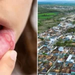 Ação de prevenção ao câncer de boca reforça cuidados com saúde bucal e atendimento especializado em Utinga